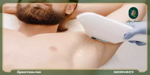 عوارض لیزر زیر بغل و بیکینی