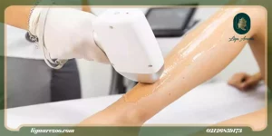 لیزر موهای زائد پا چیست و چگونه انجام می شود؟