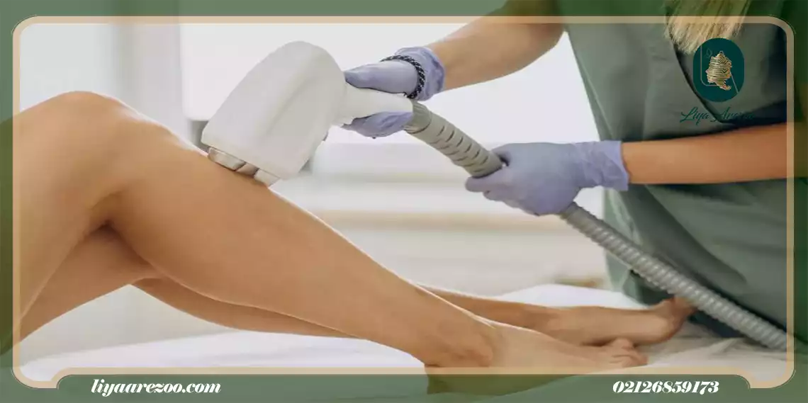 مکانیزم عملکرد لیزر موهای زائد پا در فولیکول های فعال