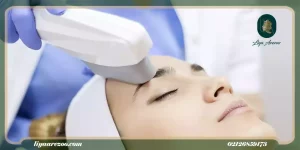 همه چیز درباره لیزر موهای زائد پیشانی