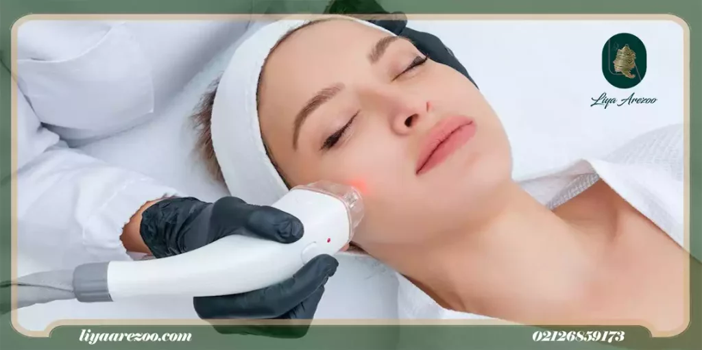 آیا با لیزر موهای کرکی صورت و بدن از بین می رود-min