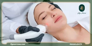 آیا با لیزر موهای کرکی صورت و بدن از بین می رود-min