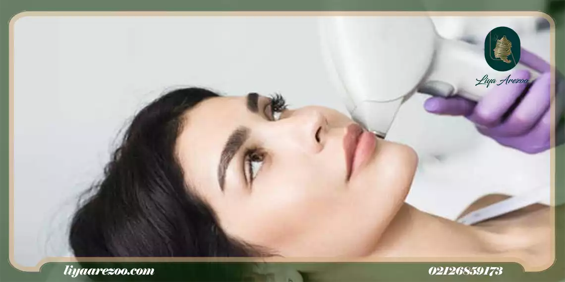قبل از شروع درمان لیزر موی سفید صورت این نکات را بدانید-min