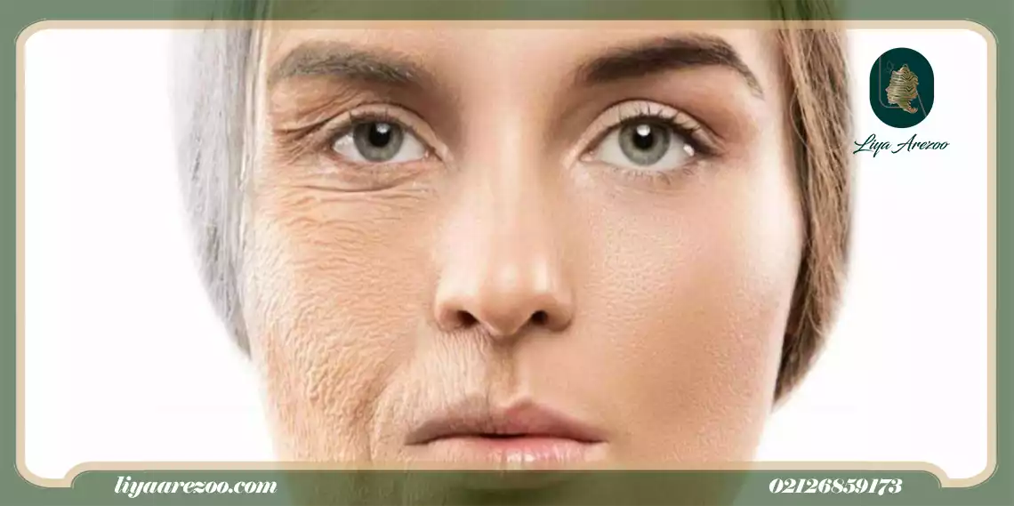 هایفوتراپی چیست و چطور باعث جوان سازی پوست می شود؟